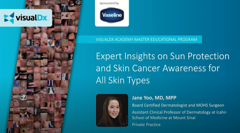 VisualDx Webinar about modern sun protection strategies