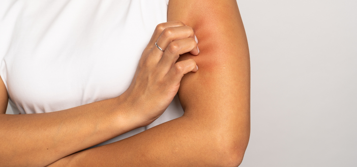 Woman scratching her arm